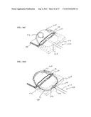 Methods and Systems for Performing Submucosal Medical Procedures diagram and image