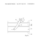 Device, Kit And Method For Closure Of A Body Lumen Puncture diagram and image