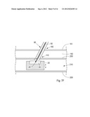 Device, Kit And Method For Closure Of A Body Lumen Puncture diagram and image