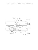 Device, Kit And Method For Closure Of A Body Lumen Puncture diagram and image