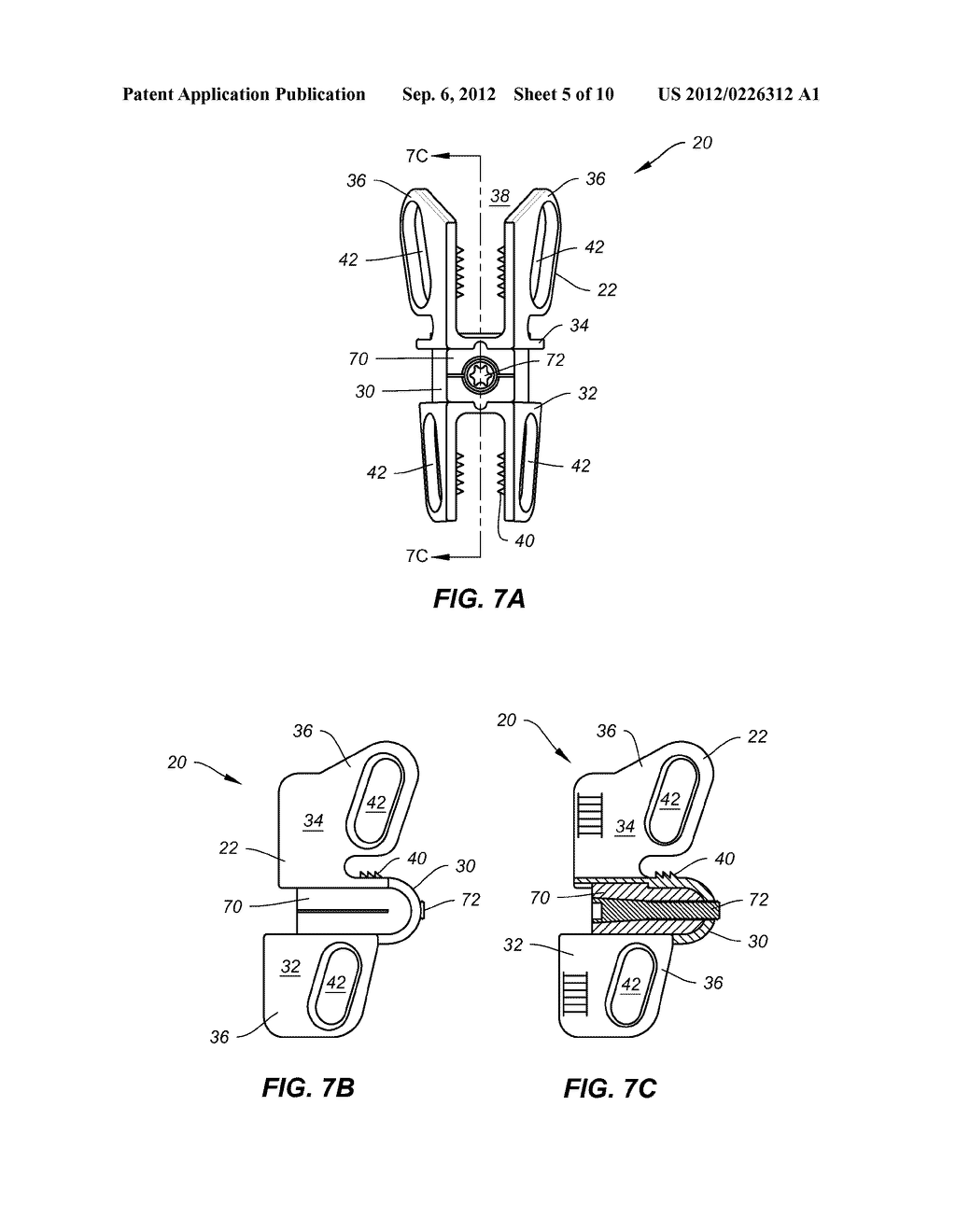 TRANSLAMINAR INTERSPINOUS STABILIZATION SYSTEM - diagram, schematic, and image 06