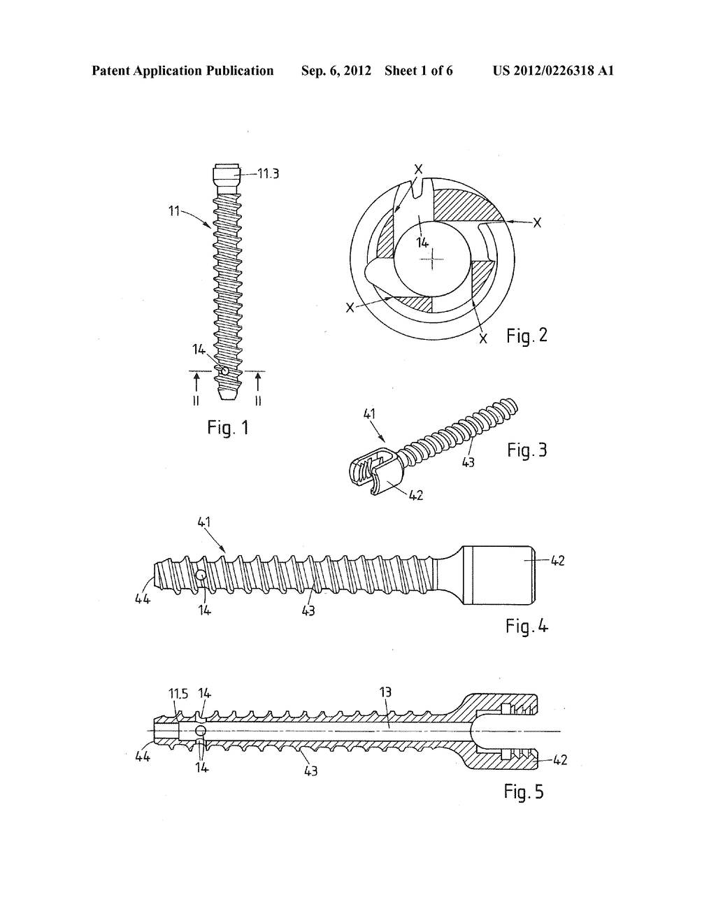 MEDICAL DEVICE, APPARATUS, AND SURGICAL METHOD - diagram, schematic, and image 02