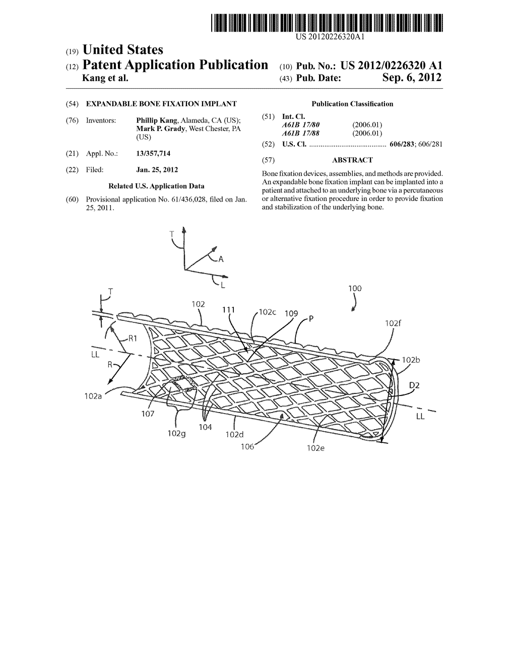 EXPANDABLE BONE FIXATION IMPLANT - diagram, schematic, and image 01