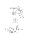 System for Seeking for an Optimal Configuration of a Bi-, Tri- or     Multi-ventricular Cardiac Resynchronization Implanted Device diagram and image