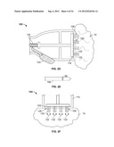 METHODS AND DEVICES FOR TREATING TISSUE diagram and image