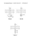 METHODS AND DEVICES FOR TREATING TISSUE diagram and image