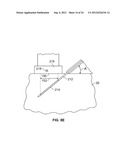 METHODS AND DEVICES FOR TREATING TISSUE diagram and image