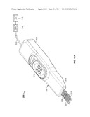 METHODS AND DEVICES FOR TREATING TISSUE diagram and image