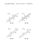 METHODS AND DEVICES FOR TREATING TISSUE diagram and image