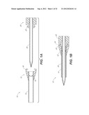 CATHETER SYSTEM AND METHODS OF USING SAME diagram and image