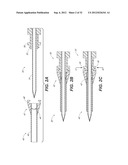 CATHETER SYSTEM AND METHODS OF USING SAME diagram and image