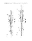 CATHETER SYSTEM AND METHODS OF USING SAME diagram and image