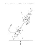 CATHETER SYSTEM AND METHODS OF USING SAME diagram and image