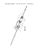 CATHETER SYSTEM AND METHODS OF USING SAME diagram and image