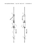 CATHETER SYSTEM AND METHODS OF USING SAME diagram and image