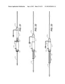 CATHETER SYSTEM AND METHODS OF USING SAME diagram and image