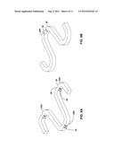 Stent with Reduced Profile diagram and image