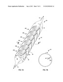 Stent with Reduced Profile diagram and image