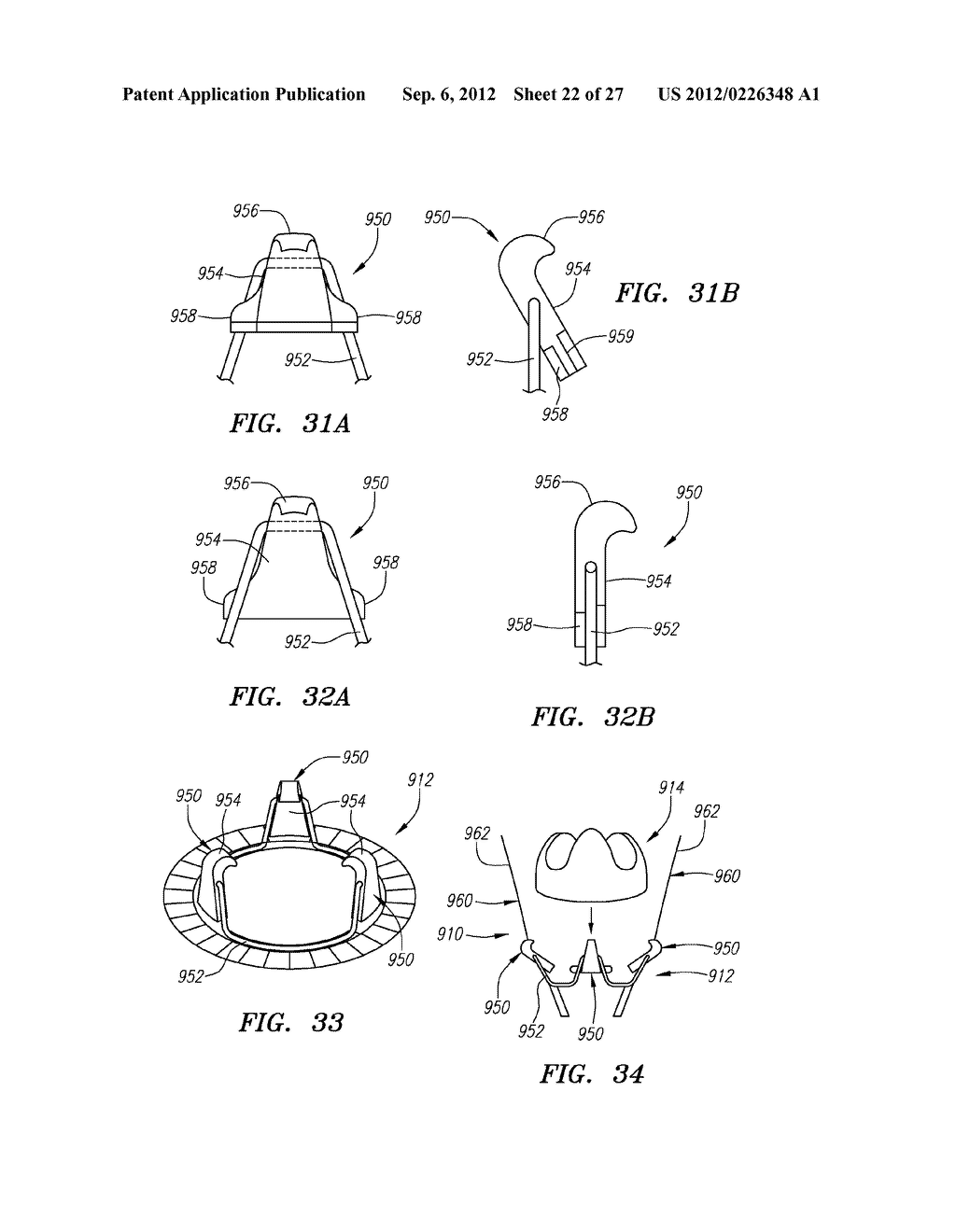 Conformable Prostheses For Implanting Two-Piece Heart Valves and Methods     for Using Them - diagram, schematic, and image 23
