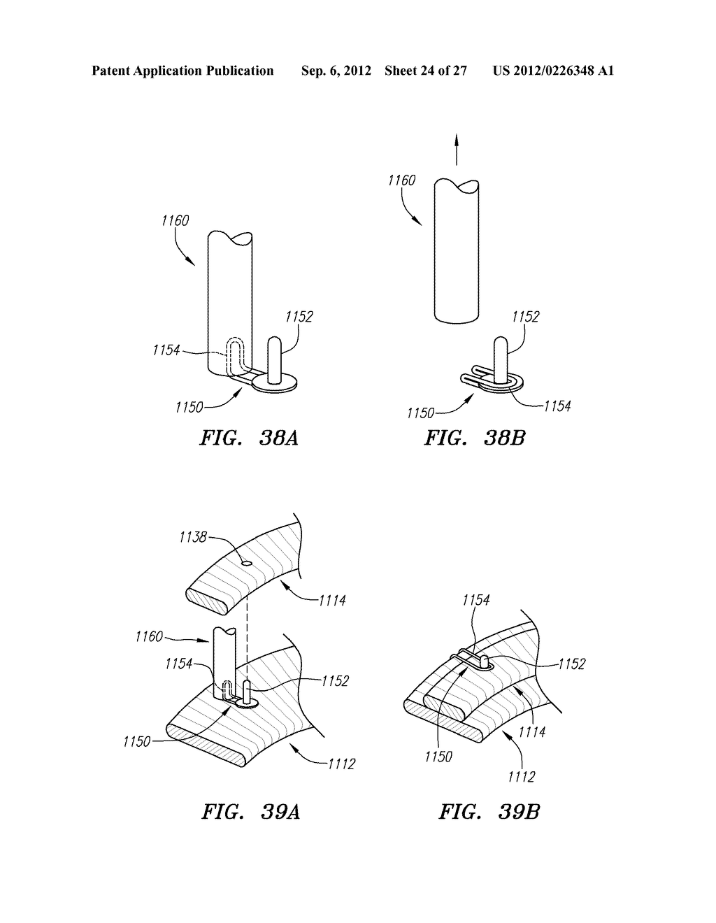 Conformable Prostheses For Implanting Two-Piece Heart Valves and Methods     for Using Them - diagram, schematic, and image 25