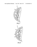 ACCOMMODATING INTRAOCULAR LENS diagram and image