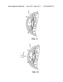 ACCOMMODATING INTRAOCULAR LENS diagram and image