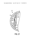 ACCOMMODATING INTRAOCULAR LENS diagram and image