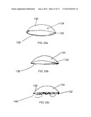 ACCOMMODATING INTRAOCULAR LENS diagram and image