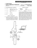 SHIELDED PROSTHETIC COMPONENT diagram and image