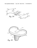 SHIELDED PROSTHETIC COMPONENT diagram and image