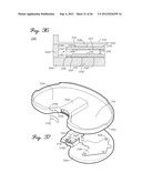 SHIELDED PROSTHETIC COMPONENT diagram and image