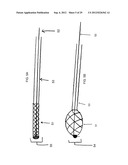 METHOD AND DEVICES FOR THE TREATMENT OF BONE FRACTURES diagram and image