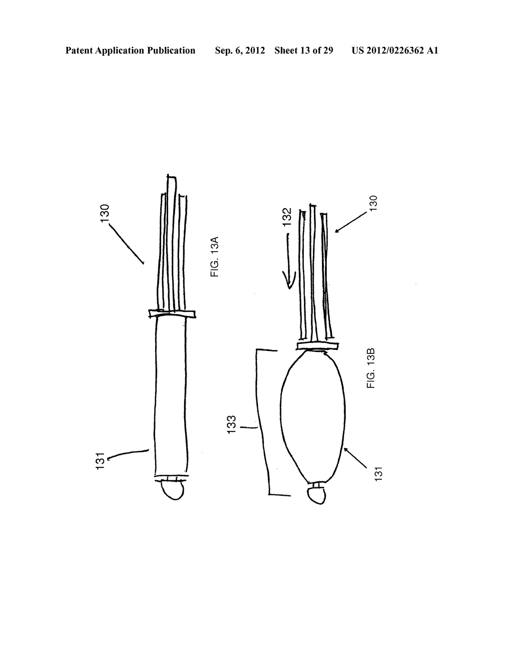 METHOD AND DEVICES FOR THE TREATMENT OF BONE FRACTURES - diagram, schematic, and image 14