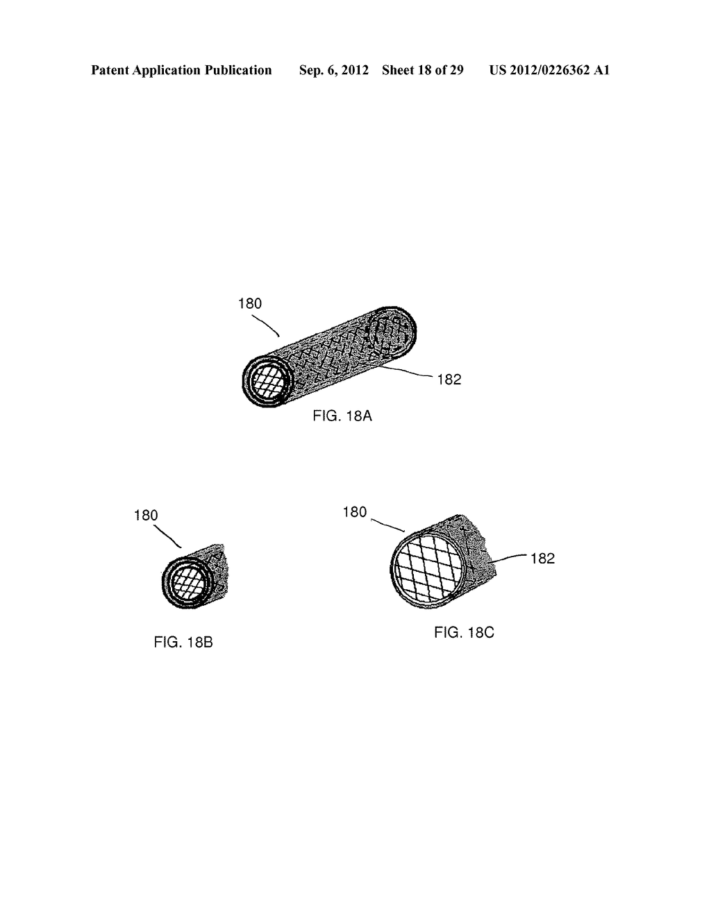 METHOD AND DEVICES FOR THE TREATMENT OF BONE FRACTURES - diagram, schematic, and image 19