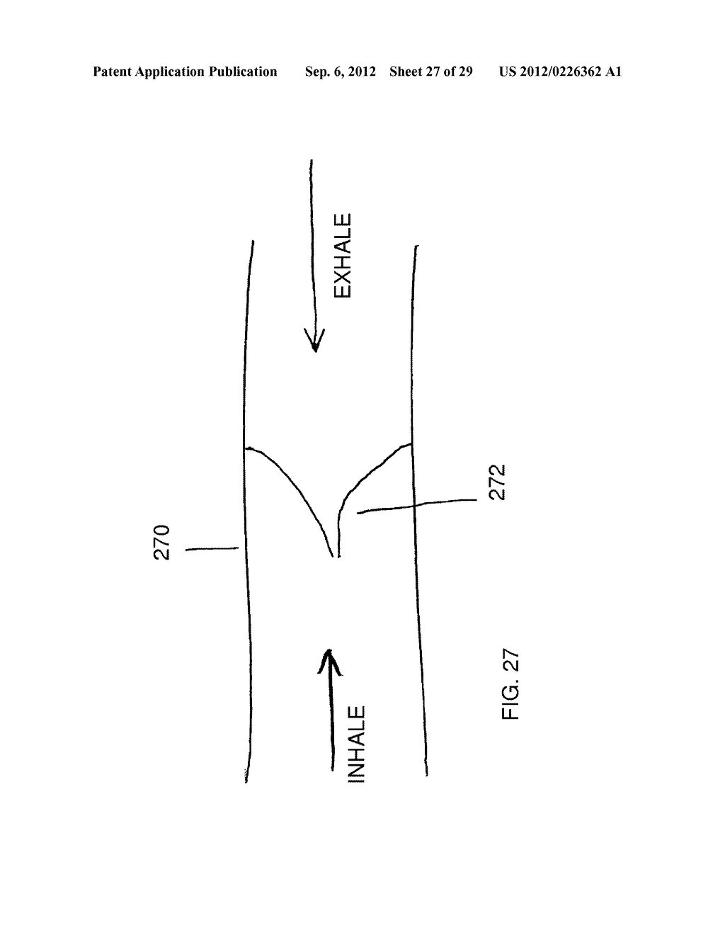 METHOD AND DEVICES FOR THE TREATMENT OF BONE FRACTURES - diagram, schematic, and image 28