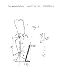 METHOD FOR CONTROLLING AN ORTHOTIC OR PROSTHETIC JOINT OF A LOWER     EXTREMITY diagram and image