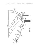 TOILET SEAT WITH PASSAGE SYSTEM FOR REMOVAL OF FOUL AIR diagram and image