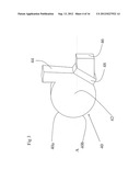 MOULD FOR METAL CASTING AND METHOD USING SAME diagram and image