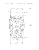 EXPANDABLE CENTRALIZER FOR EXPANDABLE PIPE STRING diagram and image