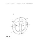 APPARATUS FOR CARRYING ONE OR MORE SUSPENDED ITEMS diagram and image