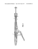 SURGICAL STAPLING DEVICE diagram and image