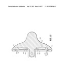 SURGICAL STAPLING DEVICE diagram and image