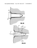 SURGICAL STAPLING DEVICE diagram and image