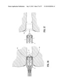 SURGICAL STAPLING DEVICE diagram and image