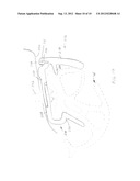 MECHANICAL SNAP RETAINER ASSEMBLY FOR  WEATHERSEAL diagram and image