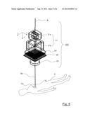 PARTICLE BEAM THERAPY SYSTEM diagram and image