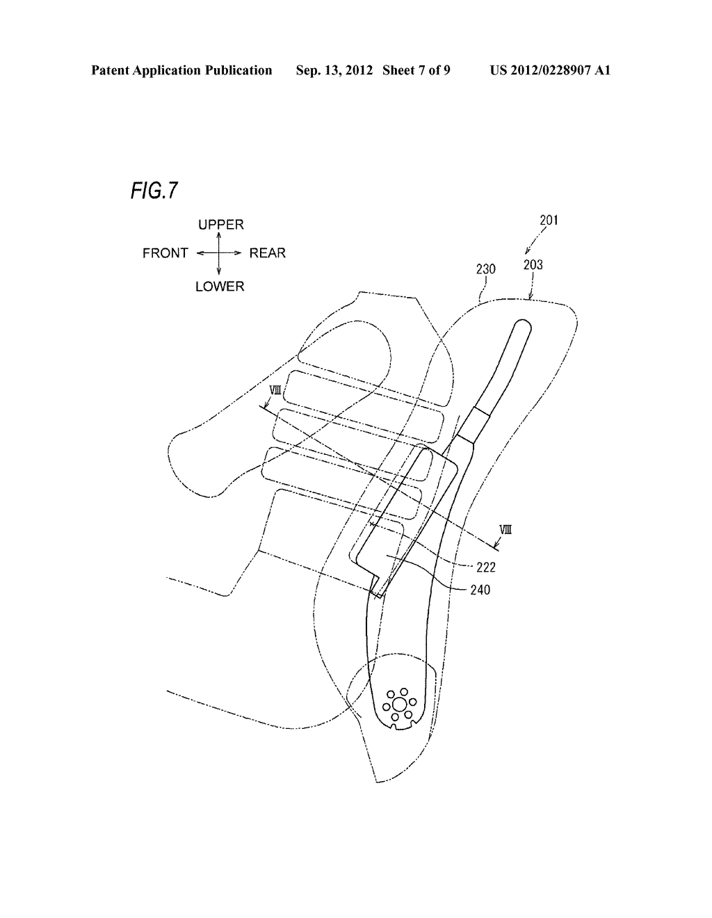 VEHICLE SEAT INCLUDING SIDE AIRBAG SYSTEM - diagram, schematic, and image 08