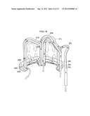 STATOR FOR ROTARY ELECTRIC MACHINE diagram and image