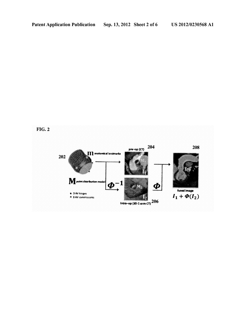 Method and System for Model-Based Fusion of Multi-Modal Volumetric Images - diagram, schematic, and image 03