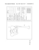 PREOPERATIVE PLANNING PROGRAM AND OPERATION SUPPORT JIG FOR HIP     REPLACEMENT ARTHROPLASTY diagram and image